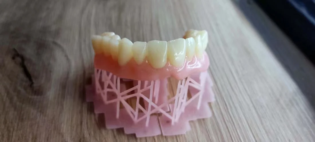 Стоматология из смолы, временная КОРОНКА для зубов, 3D печать, цвет A2, высокая прочность, УФ-фоточувствительное фотоотверждение Изображение 2